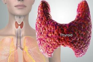 Pengertian Hipertiroid dan Hipotiroid